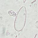 Surirella minuta