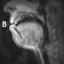 MRI-sound-articulation-ru-В